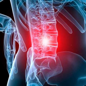 dolor lumbar remedio en clinica muñoz