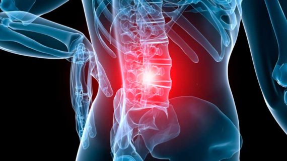 dolor lumbar remedio en clinica muñoz